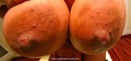 Supertetas