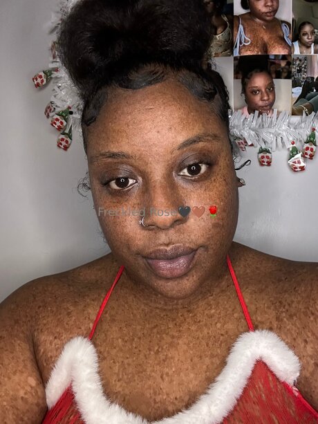 Freckledfantasy5