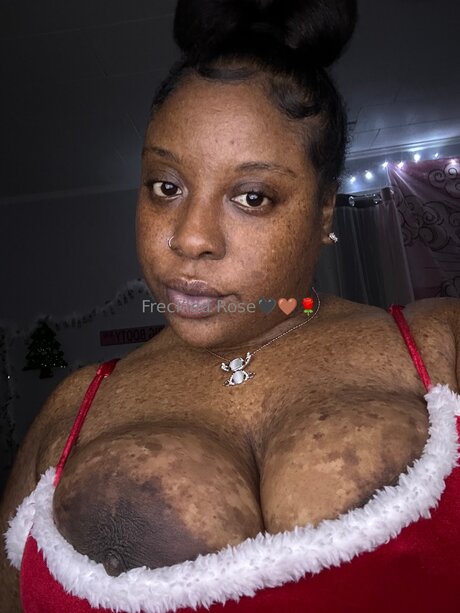 Freckledfantasy5