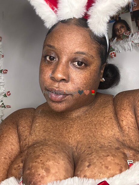 Freckledfantasy5