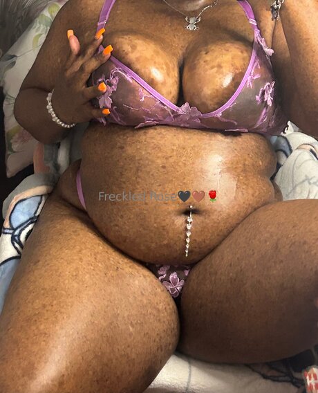 Freckledfantasy5