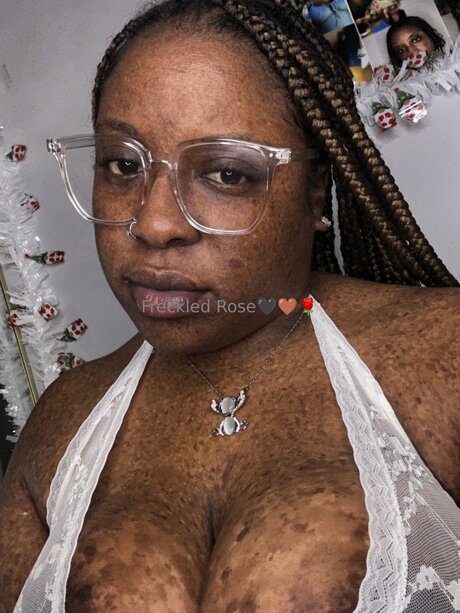 Freckledfantasy5