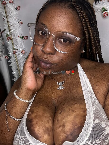 Freckledfantasy5