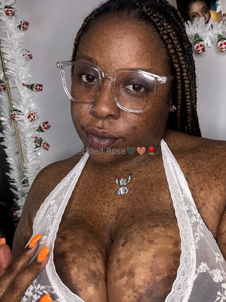 Freckledfantasy5