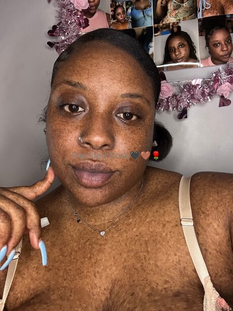 Freckledfantasy5