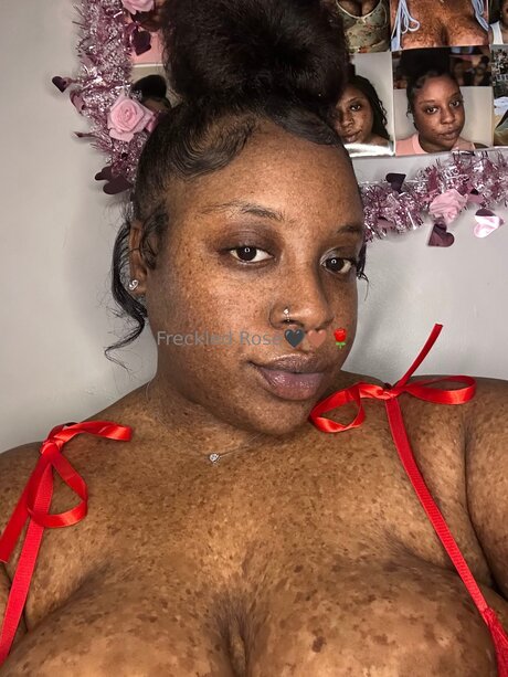 Freckledfantasy5