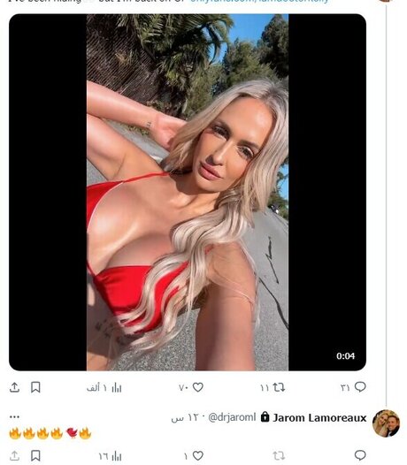 Nagie wyciekłe zdjęcie OnlyFans od Dr Kelly