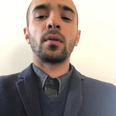 Nøgent lækket OnlyFans-billede af Marln Tesoro
