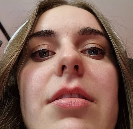 Loserfruit
