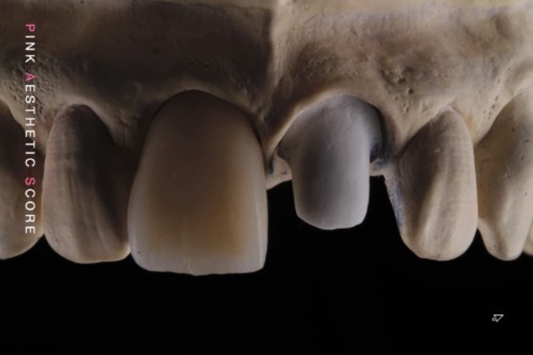 Alasti lekkinud OnlyFans-i pilt Onlydentistry #2