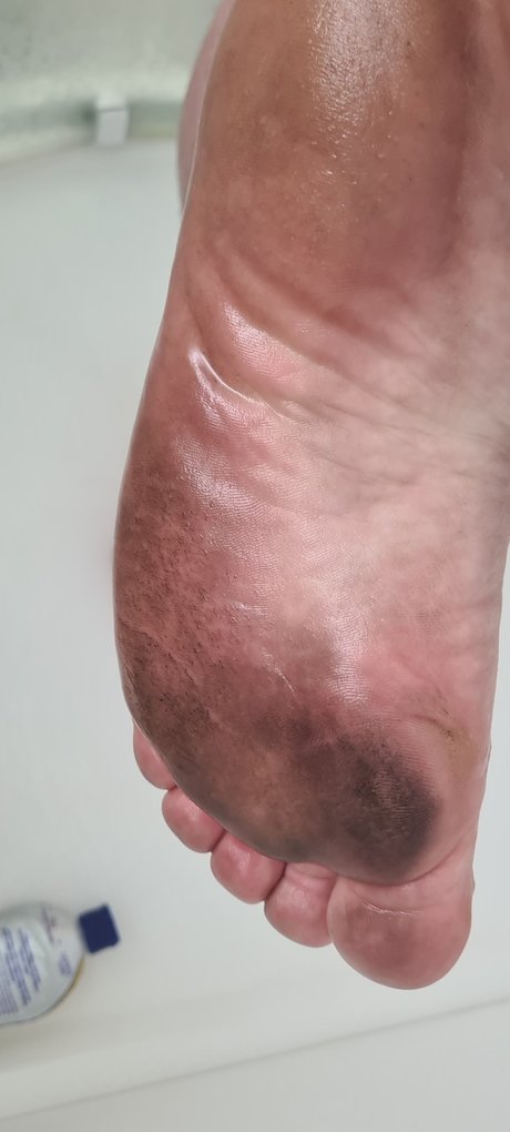 Philfeet
