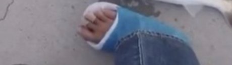 Oside Toes
