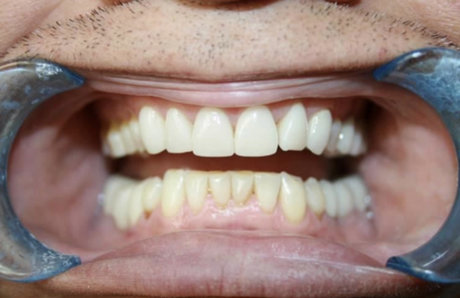 Toothfetish Doc