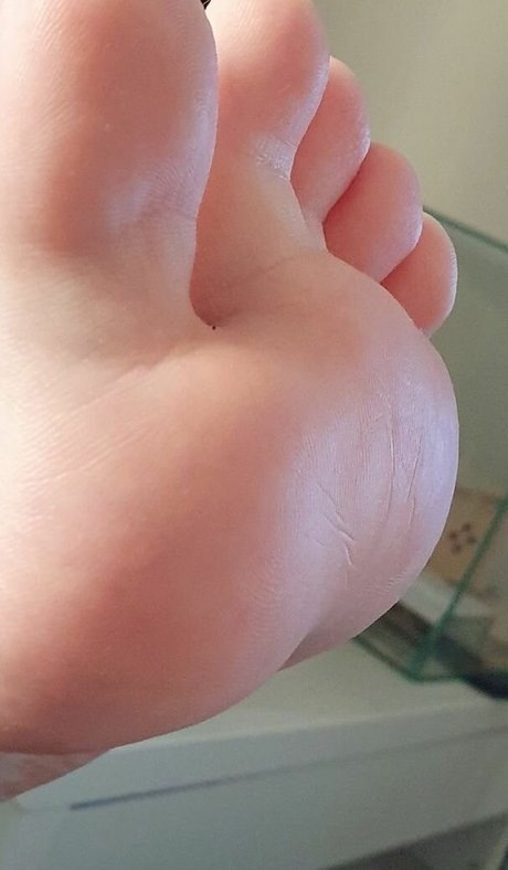 Unicornsfeet