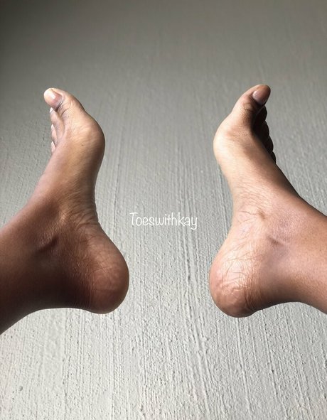 Toeswithkay2