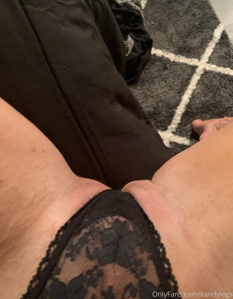 Kandylegs