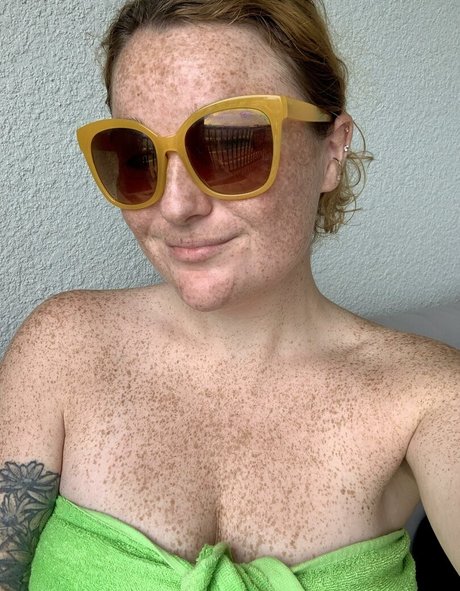 Freckled Baby