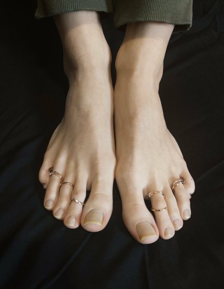 Torislegs