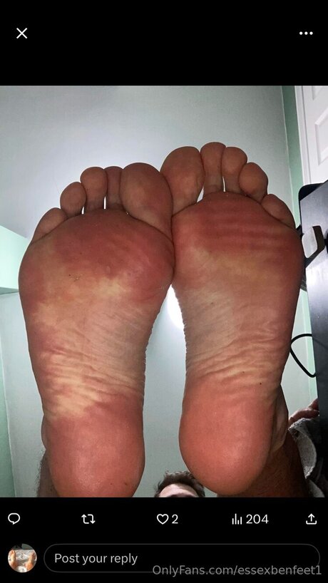 Essexbenfeet1