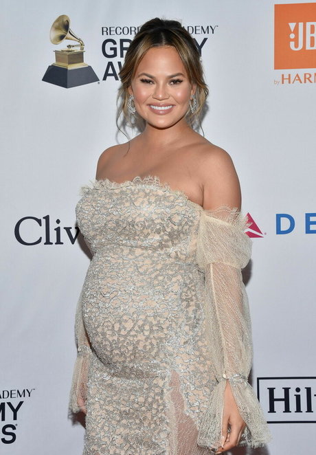 Chrissy Teigen