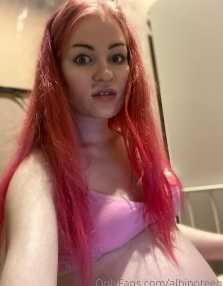 Обнаженная фотография утечки OnlyFans от Albinoteen