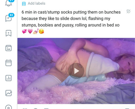 Theamputeebitch
