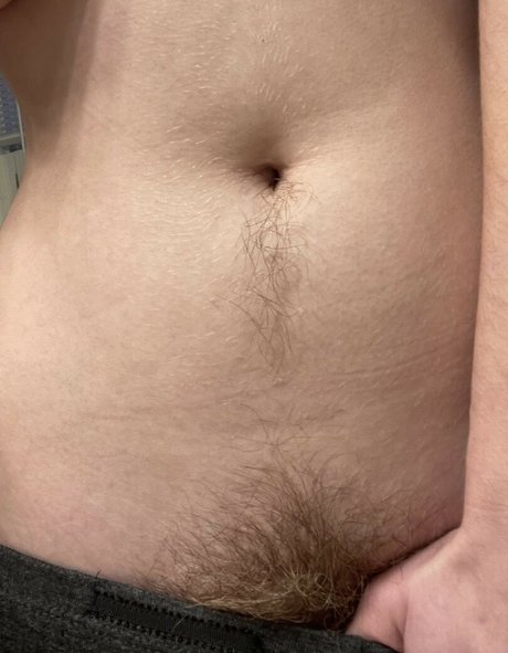 Hairy Women