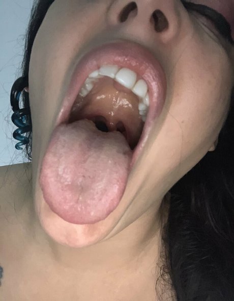 Missleanalee