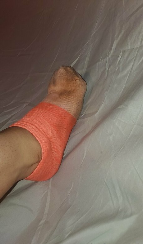 Missfeetstink