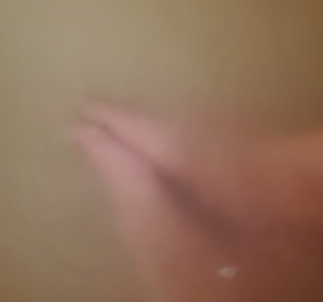 Missfeetstink