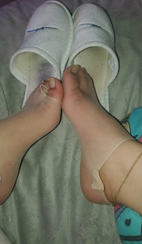 Missfeetstink