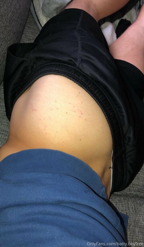 Battyboyfree OnlyFans