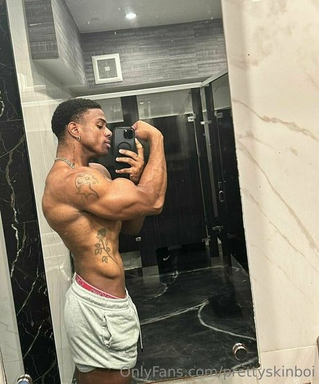 Prettyskinboi