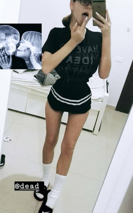 Romi