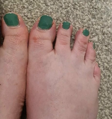 Frannysfatfeetfree