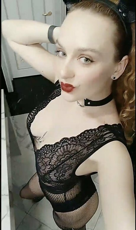 Lynabond
